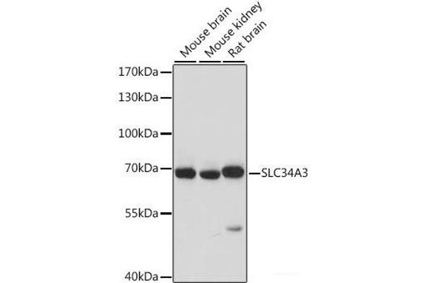 SLC34A3 抗体