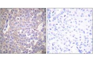 Immunohistochemistry (IHC) image for anti-Claudin 2 (CLDN2) (AA 181-230) antibody (ABIN2889174) (Claudin 2 抗体  (AA 181-230))