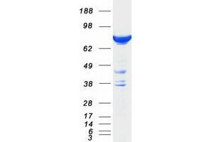 Validation with Western Blot (HID1/DMC1 Protein (Myc-DYKDDDDK Tag))