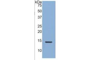 Western Blotting (WB) image for Connective Tissue Growth Factor (CTGF) ELISA Kit (ABIN6730903)