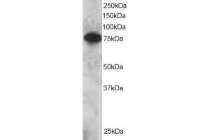 Western Blotting (WB) image for anti-SET Domain and Mariner Transposase Fusion Gene (SETMAR) (C-Term) antibody (ABIN2466262) (SETMAR 抗体  (C-Term))