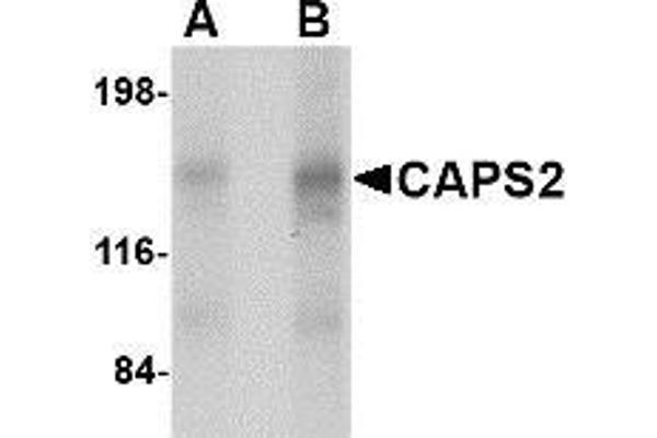 CADPS2 抗体  (Center)