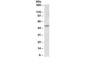 Western blot testing of human placenta lysate with Estrogen receptor beta antibody at 1ug/ml. (ESR2 抗体)
