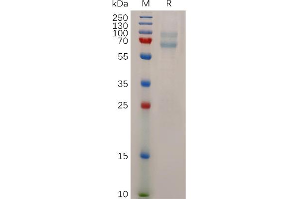 ADAM28 Protein (AA 19-664) (His tag)