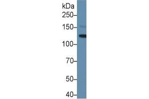 Western Blotting (WB) image for Leukemia Inhibitory Factor Receptor alpha (LIFR) ELISA Kit (ABIN6730977)