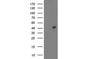 HEK293T cells were transfected with the pCMV6-ENTRY control (Left lane) or pCMV6-ENTRY MAPRE2 (Right lane) cDNA for 48 hrs and lysed. (MAPRE2 抗体)