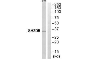 Western Blotting (WB) image for anti-SH2 Domain Containing 5 (SH2D5) (C-Term) antibody (ABIN1852147) (SH2D5 抗体  (C-Term))