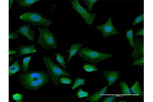 Immunofluorescence of purified MaxPab antibody to ITGAX on HeLa cell. (CD11c 抗体  (AA 1-1169))