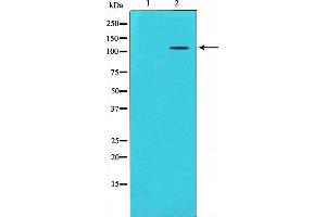 Western blot analysis on mouse brain lysate using GluR5 Antibody,The lane on the left is treated with the antigen-specific peptide. (GRIK1 抗体  (Internal Region))