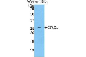 Western Blotting (WB) image for anti-Glutathione S-Transferase mu 1 (GSTM1) (AA 1-218) antibody (ABIN1859091) (GSTM1 抗体  (AA 1-218))