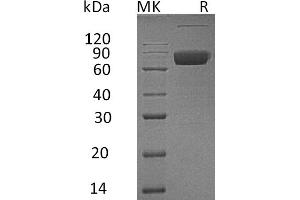 Greater than 95 % as determined by reducing SDS-PAGE. (IL10RB Protein (Fc Tag))