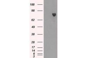 Western Blotting (WB) image for anti-Bruton Agammaglobulinemia tyrosine Kinase (BTK) antibody (ABIN1496973) (BTK 抗体)