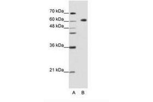 GMEB2 抗体  (C-Term)