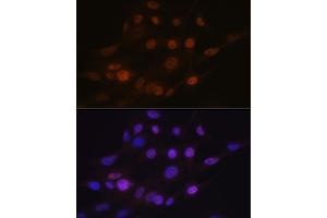 Immunofluorescence analysis of C6 cells using B Rabbit mAb (ABIN7265377) at dilution of 1:100 (40x lens). (ANP32B 抗体)