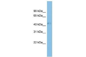 RRAGD antibody used at 1 ug/ml to detect target protein. (RRAGD 抗体  (Middle Region))