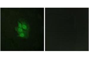 Immunofluorescence analysis of HeLa cells, using p53 (Phospho-Ser392) Antibody. (p53 抗体  (pSer392))