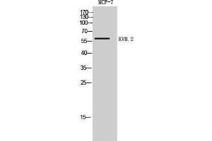 Western Blotting (WB) image for anti-Potassium Channel, Subfamily V, Member 2 (KCNV2) (Internal Region) antibody (ABIN3175800) (KCNV2 抗体  (Internal Region))