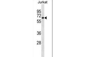 CD25 Antibody ABIN1539791 western blot analysis in Jurkat cell line lysates (35 μg/lane). (CD25 抗体)