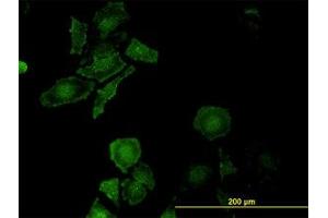 Image no. 2 for anti-Leucine Proline-Enriched Proteoglycan (Leprecan) 1 (LEPRE1) (AA 1-100) antibody (ABIN599294) (LEPRE1 抗体  (AA 1-100))