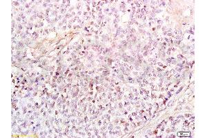 Immunohistochemistry (Paraffin-embedded Sections) (IHC (p)) image for anti-High Mobility Group Box 1 (HMGB1) (AA 75-170) antibody (ABIN671616)