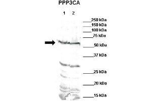 WB Suggested Anti-PPP3CA Antibody    Positive Control:  Lane 1: 80ug mouse brain extractLane 2: 80ug rat brain extract  Primary Antibody Dilution :   1:500  Secondary Antibody :  IRDye 800 CW goat anti-rabbit from Li-COR Bioscience  Secondry Antibody Dilution :   1:20,000  Submitted by:  Dr. (PPP3CA 抗体  (N-Term))
