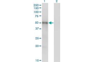 Western Blotting (WB) image for anti-MAP Kinase Interacting serine/threonine Kinase 1 (MKNK1) (AA 1-466) antibody (ABIN599046) (MKNK1 抗体  (AA 1-466))