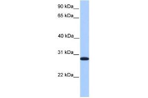 CDKN3 antibody used at 1 ug/ml to detect target protein. (CDKN3 抗体)