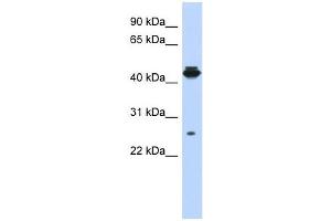 PDIK1L antibody used at 1 ug/ml to detect target protein. (PDIK1L 抗体  (Middle Region))