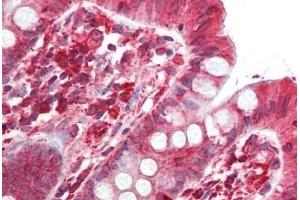 Human Colon: Formalin-Fixed, Paraffin-Embedded (FFPE) (SGSM2 抗体  (Internal Region))