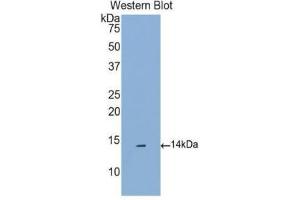 Western Blotting (WB) image for anti-Chemokine (C-C Motif) Ligand 16 (CCL16) (AA 20-120) antibody (ABIN1174246) (CCL16 抗体  (AA 20-120))