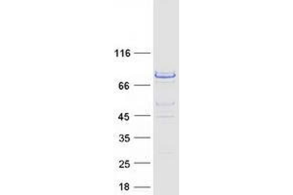 WRAP53 Protein (Transcript Variant 1) (Myc-DYKDDDDK Tag)