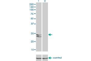 Western Blotting (WB) image for anti-RAB27A, Member RAS Oncogene Family (RAB27A) (AA 122-221) antibody (ABIN562560)