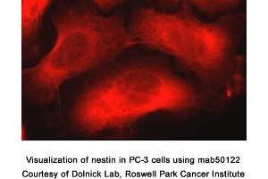 Image no. 1 for anti-Nestin (NES) (AA 1464-1614) antibody (ABIN363276) (Nestin 抗体  (AA 1464-1614))