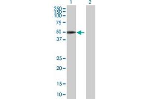 Western Blot analysis of PAX6 expression in transfected 293T cell line by PAX6 MaxPab polyclonal antibody. (PAX6 抗体  (AA 1-422))