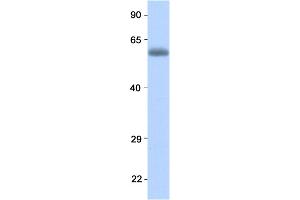 Host:  Rabbit  Target Name:  RELA  Sample Type:  Human Fetal Lung  Antibody Dilution:  1. (NF-kB p65 抗体  (N-Term))