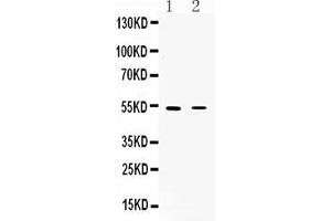 CHRNA5 抗体  (N-Term)