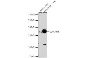 Western blot analysis of extracts of various cell lines, using CEACAM5 antibody (ABIN6291892) at 1:1000 dilution. (CEACAM5 抗体)