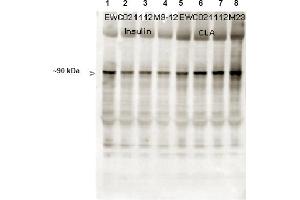 Immunoblotting. (Glycogen Synthase 抗体  (pSer641))