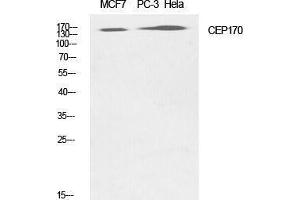 CEP170 抗体  (Internal Region)