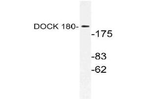 Western blot (WB) analysis of DOCK 180 antibody in extracts from HUVEC cells. (DOCK1 抗体)