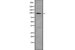 Western blot analysis of HNRNPUL1 using COLO205 whole  lysates. (HNRNPUL1 抗体  (C-Term))