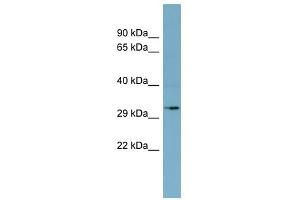 MGC4172 antibody used at 1 ug/ml to detect target protein. (MGC4172 (Middle Region) 抗体)