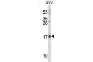 Western Blotting (WB) image for anti-ISG15 Ubiquitin-Like Modifier (ISG15) antibody (ABIN2996231) (ISG15 抗体)