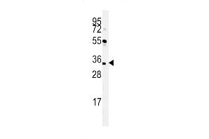 Western blot analysis of C Antibody (C-term) (ABIN651404 and ABIN2840219) in mouse liver tissue lysates (35 μg/lane). (C21ORF56 抗体  (C-Term))