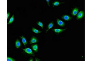 Immunofluorescent analysis of A549 cells using ABIN7149021 at dilution of 1:100 and Alexa Fluor 488-congugated AffiniPure Goat Anti-Rabbit IgG(H+L) (ATG4B 抗体  (AA 350-400))
