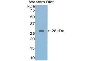 Western blot analysis of the recombinant protein. (Retinoic Acid Receptor alpha 抗体  (AA 237-459))