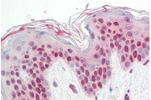 Human Skin: Formalin-Fixed, Paraffin-Embedded (FFPE) (TFEB 抗体  (N-Term))