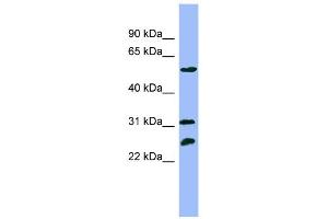 WB Suggested Anti-PSMC4 Antibody Titration: 0. (PSMC4 抗体  (N-Term))