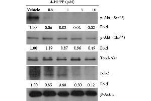 Western Blotting (WB) image for anti-B-Cell CLL/lymphoma 2 (BCL2) (N-Term) antibody (ABIN2857047)