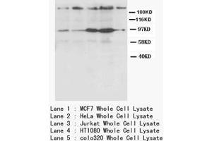 CXCR4 Polyclonal Antibody (CXCR4 抗体  (N-Term))